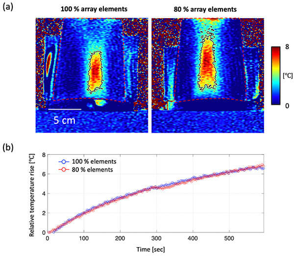 Volumetric HT distributions in the phantom comparing 100% and 80% array activation.