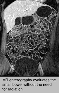 Body imaging | CT of the abdomen and pelvis | UCSF Radiology