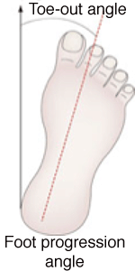 Foot progression angle