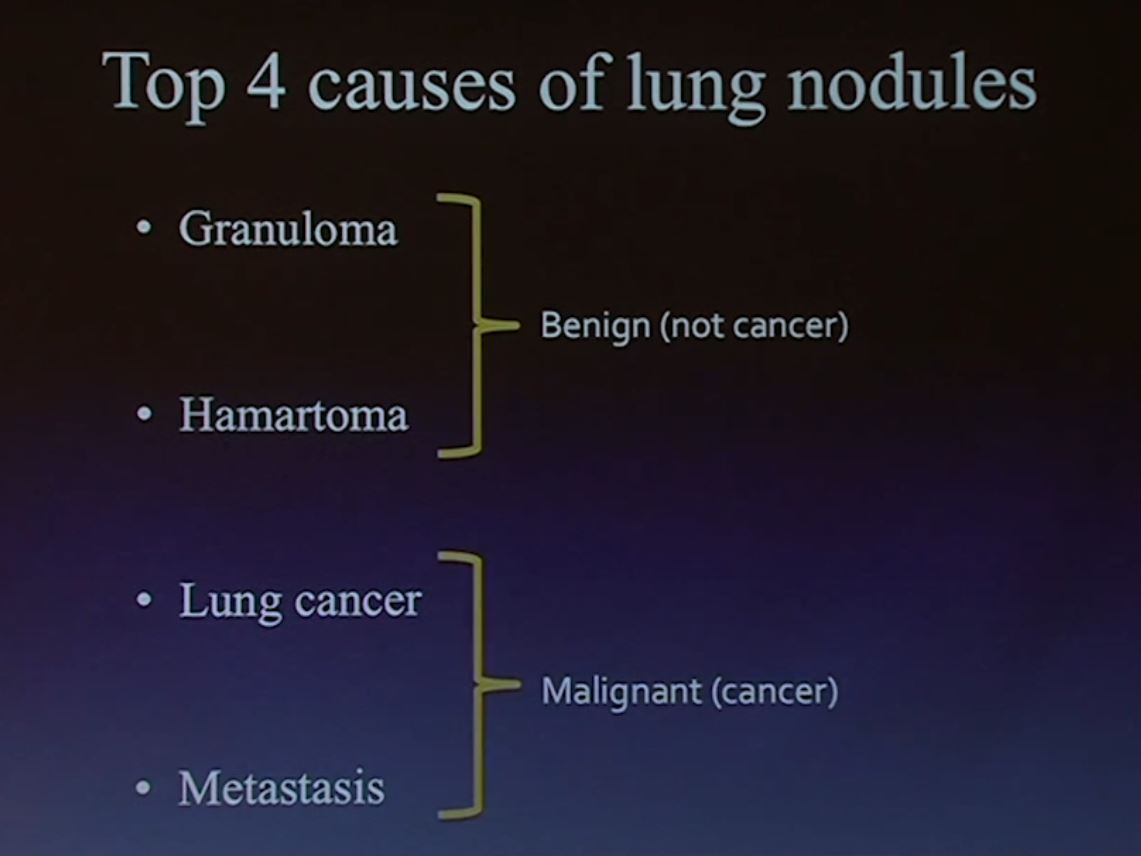 Top 4 Causes of Lung Nodules