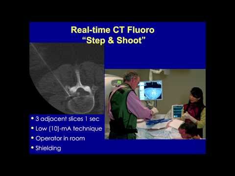Arthrogram using real-time CT fluoro