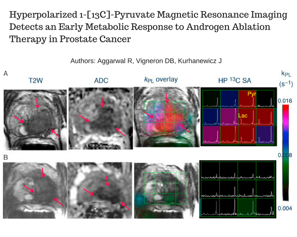 Hyperpolarized MRI Technology Resource Center