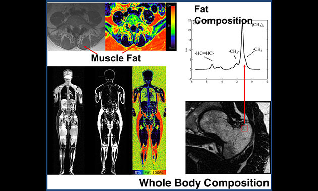 Whole Body Imaging - Musculoskeletal Magnetic Resonance Imaging Lab