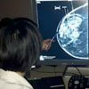 Breast Cancer: Optimizing Early Detection and Personalized Treatment