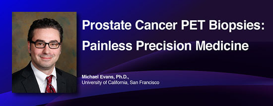 Prostate Cancer PET Biopsies: Painless Precision Medicine