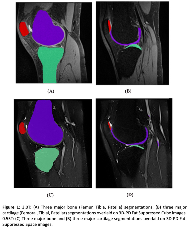 diagram bone, cartilage segmentations