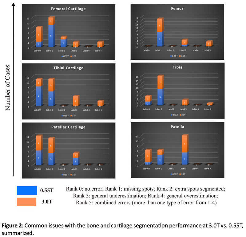 Diagram: Figure 2: Common issues with the bone and cartilage segmentation performance at 3.0T vs. 0.55T, summarized.
