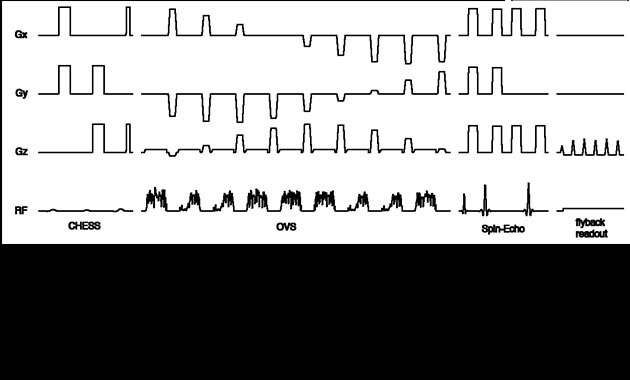 3D MRSI pulse sequence