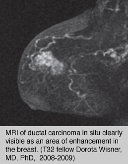 T32 Coursework: radiation oncology