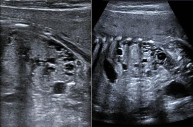Ultrasound Technology - UCSF Medical