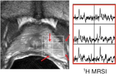 metabolic imaging