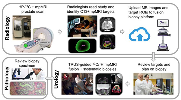 HP C-13 multiparametric MRI Prostate Cancer Biopsy Guidance Workflow. Graphic depicting HP C-13 multiparametric MRI Prostate Cancer Biopsy Guidance Workflow