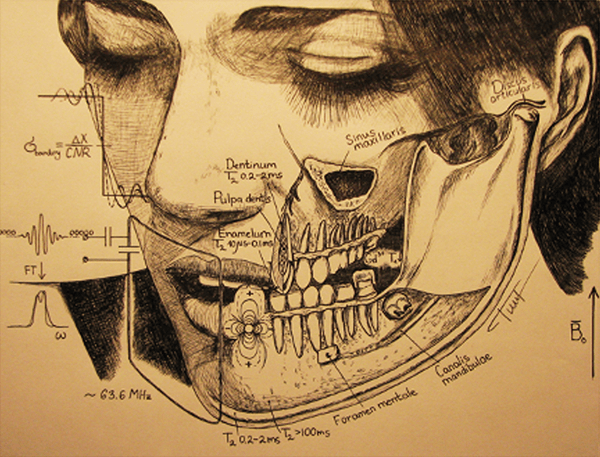 “Dental MRI” – A drawing Dr. Tymofiyeva made to illustrate her PhD work. “Dental MRI” – A drawing Dr. Tymofiyeva made to illustrate her PhD work.