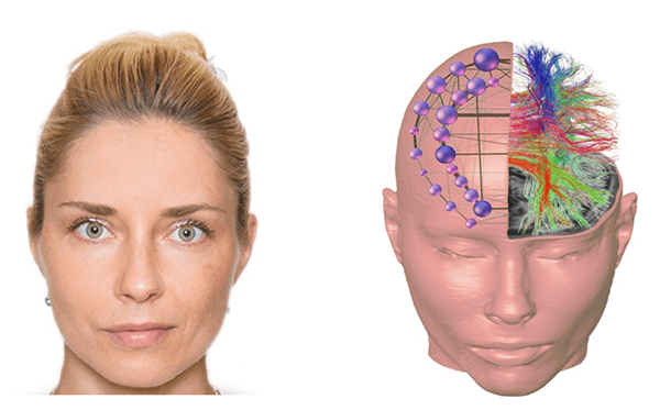 "I am Connectome" - Olga Tymofiyeva sees herself as her connectome, a network of connections in a nervous system. The quote “I am my connectome” originated from a TED talk with the same title by the physicist Dr. Sebastian Seung. The 3D head reconstruction on the right is based on an MRI scan of Dr. Tymofiyeva’s brain. I am Connectome