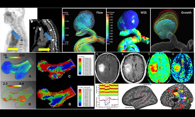 Master of Science in Biomedical Imaging (MSBI) Research