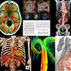 Master of Science in Biomedical Imaging (MSBI) program