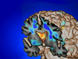 Master of Science in Biomedical Imaging (MSBI)