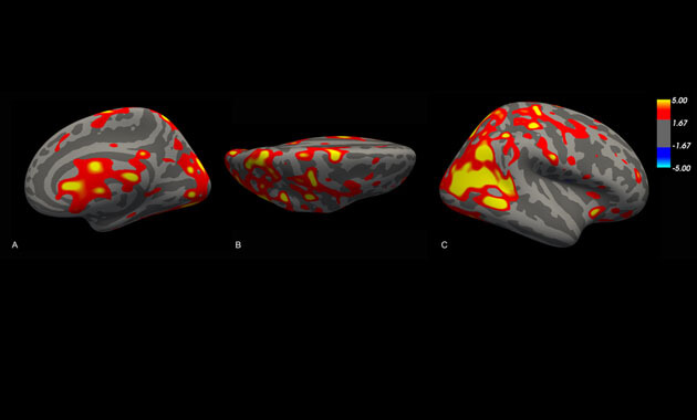 Analysis of relationship between cerebral morphology and neurocognitive development