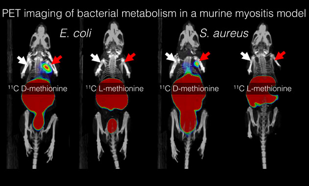 Imaging bacterial infection - Javier Villanueva-Meyer, MD