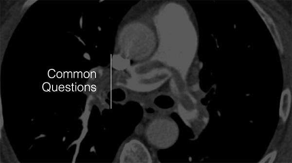 Cardiothoracic Common Questions