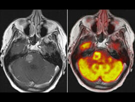 T32 Program - Biomedical Imaging for Clinician Scientists