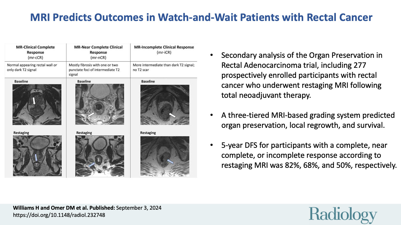 DOI: 10.1148/radiol.232748 Poster for "MRI Predicts Outcomes in Watch-and-wait Patients with rectal cancer