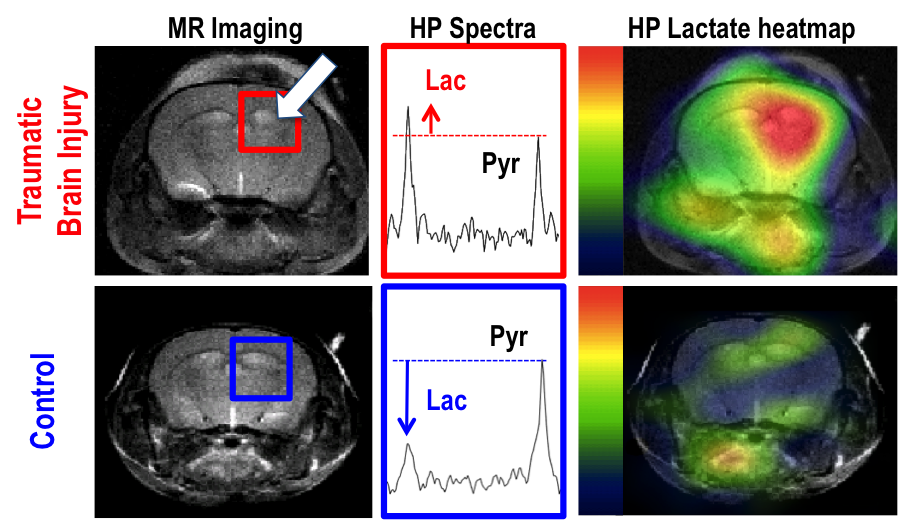 Figure shows the first hyperpolarized imaging of a TBI mouse.