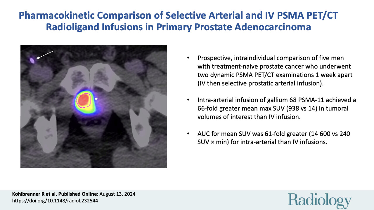 DOI: 10.1148/radiol.232544 Poster for "Pharmacokinetic Comparison of Selective Arterial and IV PSMA PET/CT"