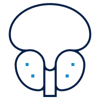 Illustration of a prostate