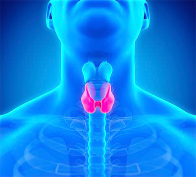 Hypothyroidism Disease