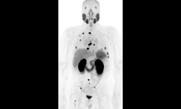 Clinical, Probes and Molecular Therapy