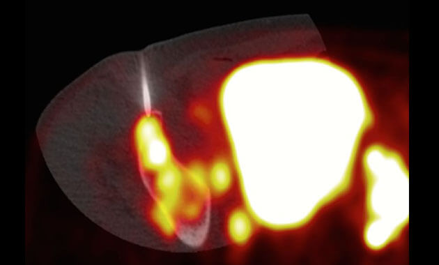 Chemistry, Probes & Molecular Therapy (CPMT)