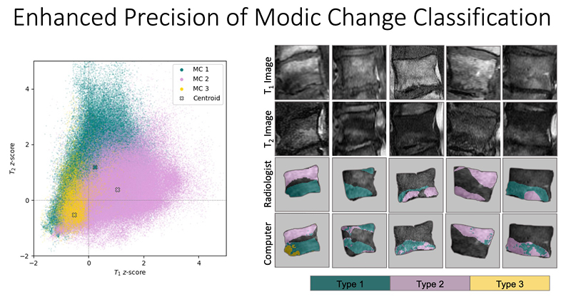 Enhanced Precision of Modic Change Classification diagram precision modic change