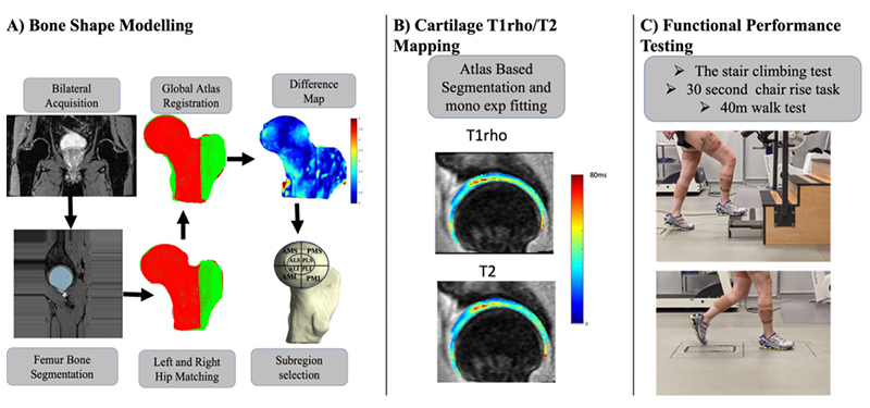 A) Bone shape Modeling B) Cartilage T1rho/T2 Mapping C) Functional Performance Testing KICK Study: Hip-Knee joint bone and cartilage interaction