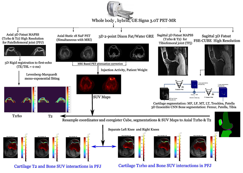 Cartilage T2/T1rho and Bone SUV interactions in PFJ Bone and cartilage interaction joint