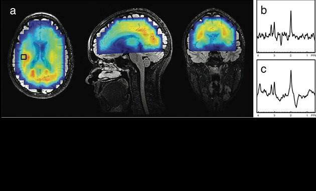 3D MRSI a metabolite map and sample spectra