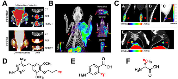 Nuclear imaging of bacterial infection- the state of the art and future directions