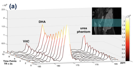 Qin H, Carroll VN, Sriram R, Villanueva-Meyer JE, von Morze C, Wang ZJ, Mutch CA, Keshari KR, Flavell RR, Kurhanewicz J, Wilson DM*. Imaging glutathione depletion in the rat brain using ascorbate-derived hyperpolarized MR and PET probes
