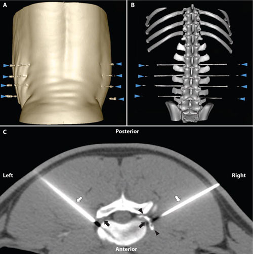 CT-guided injection of a TRPV1 agonist around dorsal root ganglia decreases pain transmission in swine.