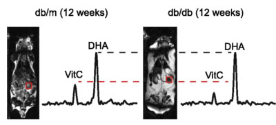 Non-invasive in vivo imaging of diabetes-induced renal oxidative stress and response to therapy using hyperpolarized 13C dehydroascorbate magnetic resonance