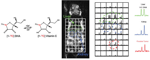 Hyperpolarized [1-13C] dehydroascorbate as an endogenous redox sensor for in vivo metabolic imaging