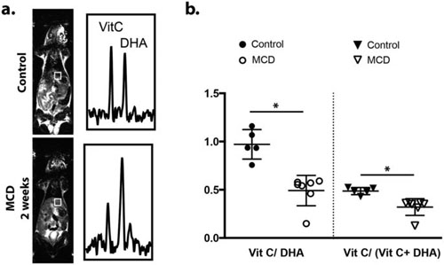 Imaging oxidative stress in non-alcoholic fatty liver disease using hyperpolarized 13C MRI