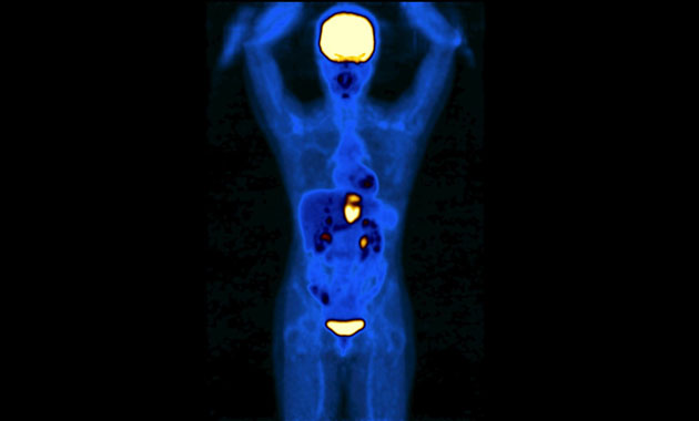 Molecular Imaging and Therapeutics Clinical Section