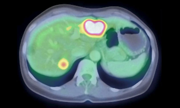 Molecular Imaging and Therapeutics Clinical Section