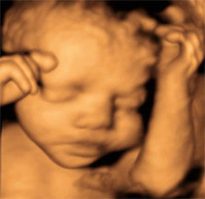 3D ultrasound of unborn baby.