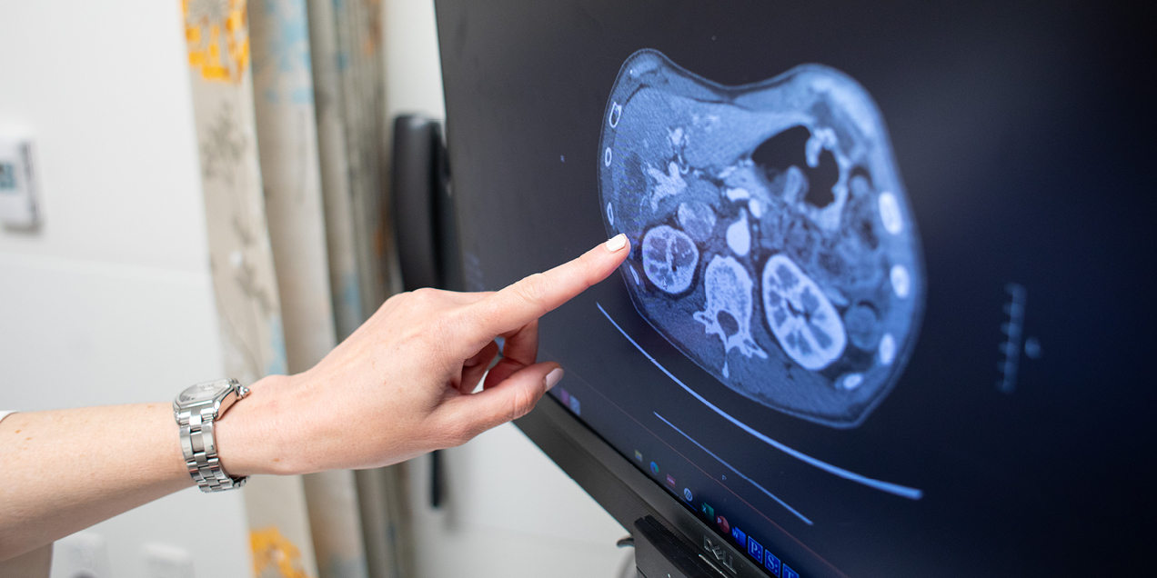 CT scan displayed on a medical imaging monitor during clinical review.