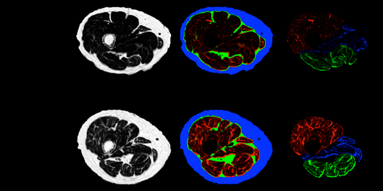 Axial MRI cross sections of the lower leg showing grayscale anatomy alongside color coded segmentation maps that highlight muscle groups and surrounding tissues, illustrating quantitative musculoskeletal imaging analysis.