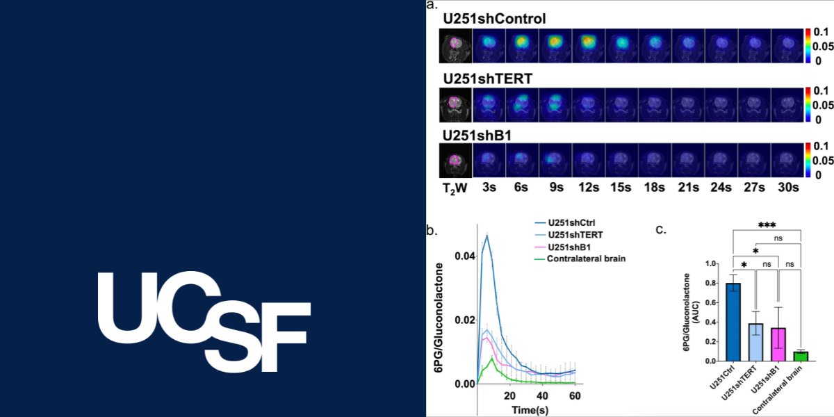 UCSF Team Studies Non-Invasive Imaging To Monitor Therapy Response In ...