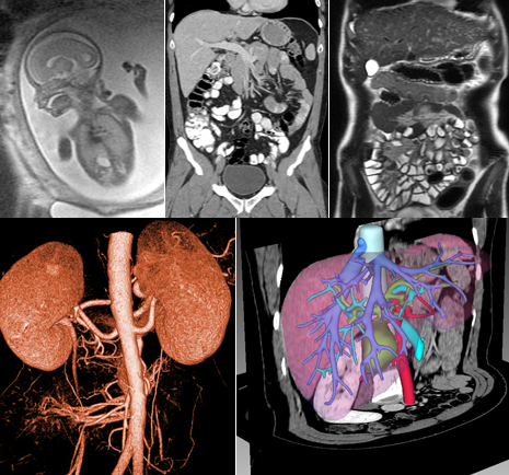 Abdominal x-rays | CT of the abdomen and pelvis | UCSF Radiology