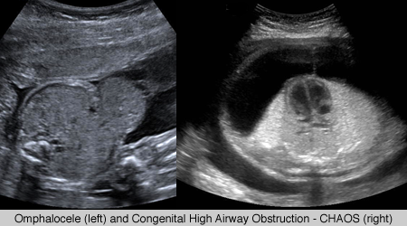Fetal Imaging - UCSF Medical